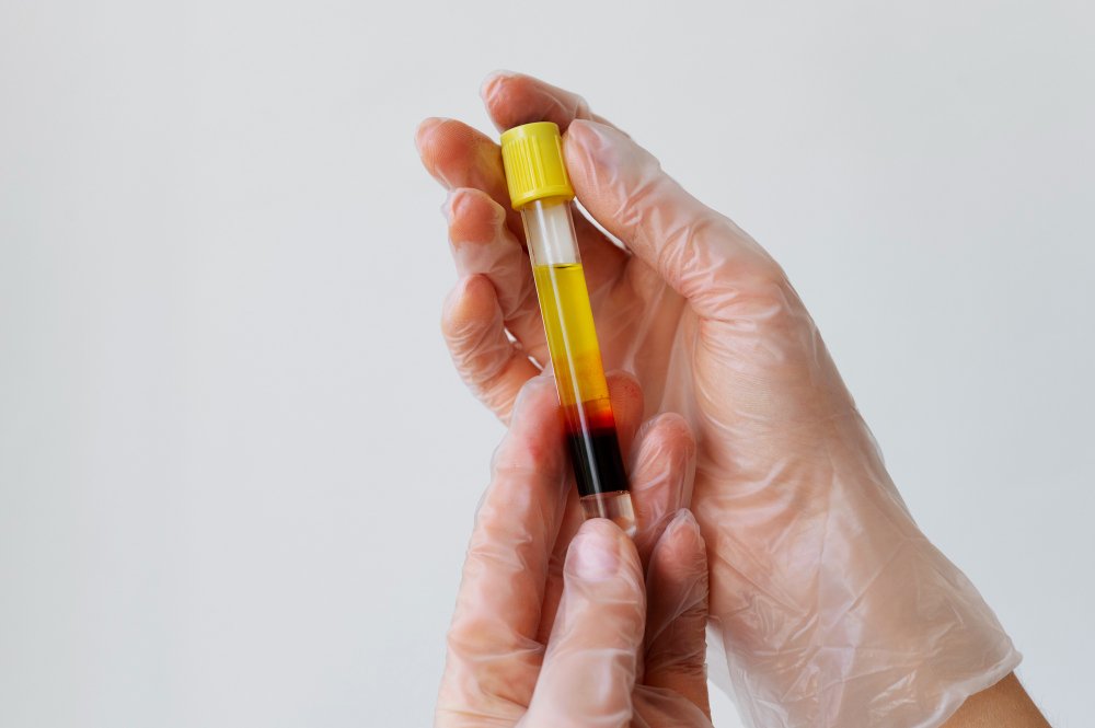 How Plasma Exchange Affects Aging in a Human Trial